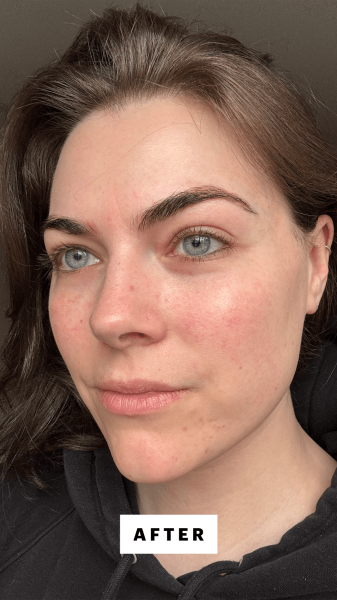 DallAsen after applying he Silver Mirror Signature Facial Mask Set