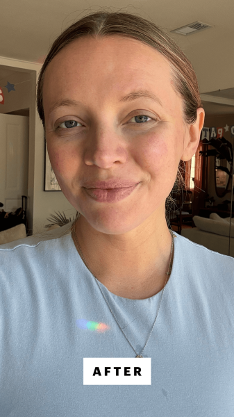 Fowler after applying the Aprilskin Real Calendula PeelOff Pack